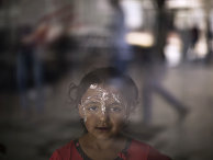 Syrian girl Rahaf Kaddour, 5, who was burnt in an explosion that hit her home, poses for a picture at MSF Hospital for Specialized Reconstructive Surgery in Amman, Jordan